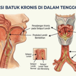 Ketika Batuk Tak Mau Pergi: Kenali Penyebab dan Cara Ampuh Mengatasinya